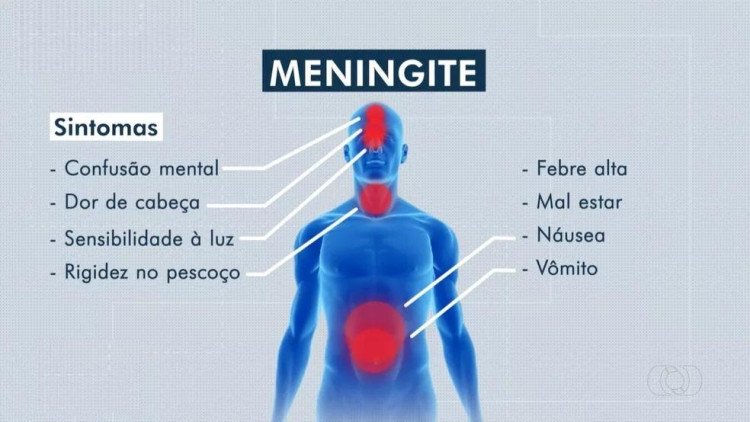 Surto de meningite em Mato Grosso acende alerta: 27 casos e 6 mortes são confirmados em 2025