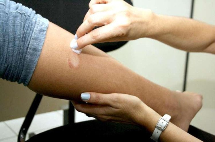 Dados alarmantes: hanseníase dispara em MT e Estado e Municípios são pressionados a agir